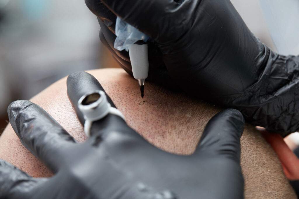 Tratamiento de micropigmentación en Barrio Salamanca