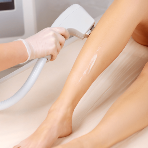 Depilación láser en Barrio Salamanca